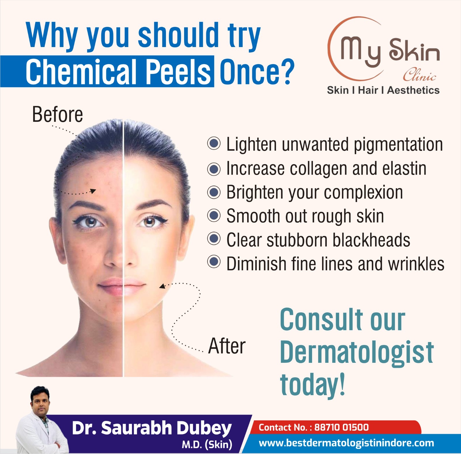 Best Skin Specialist for Chemical Peel Treatment in Indore